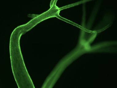 Stretching the Immortal Hydra